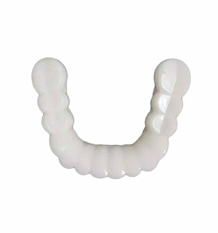 لمینت متحرک دندان دو فک TruSmile
